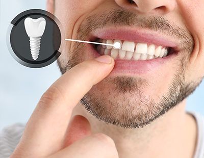 The image shows a man with a toothbrush in his mouth examining his teeth in front of an illustration of a tooth with a drill bit, emphasizing dental care.