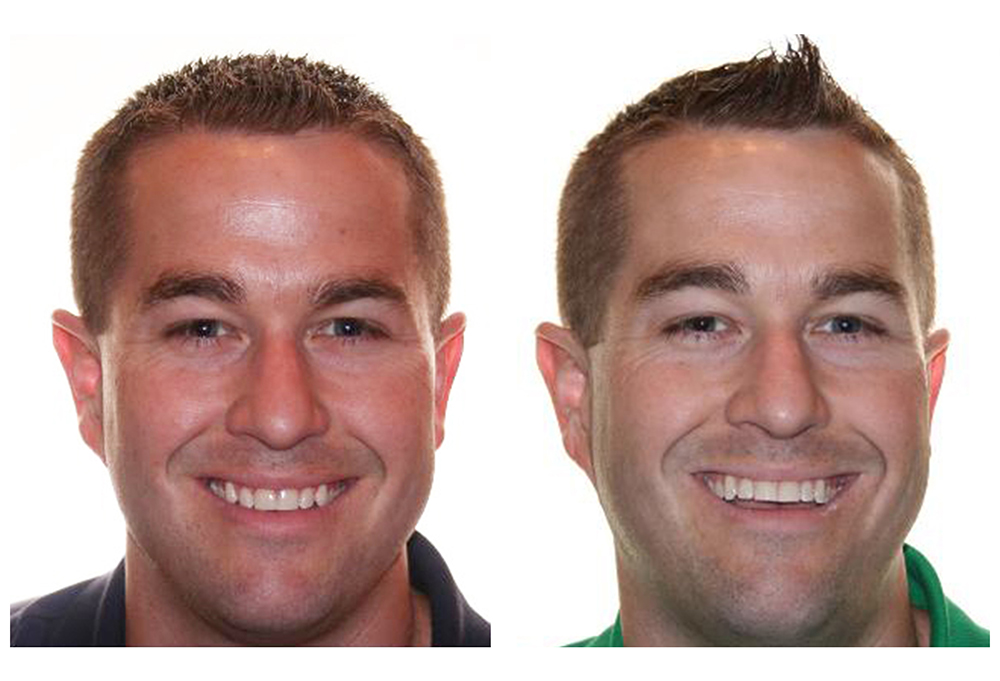 Newpoint Family Dental 