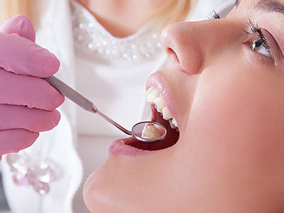 A woman seated with her mouth wide open under a dental drill, receiving dental treatment from a professional wearing gloves and a stethoscope around her neck.