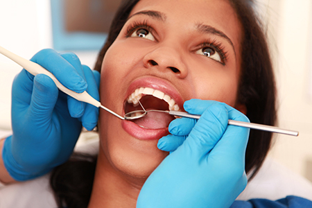 A woman receiving dental treatment with her mouth open, wearing blue gloves, sitting in a dentist s chair while a dental professional works on her teeth.